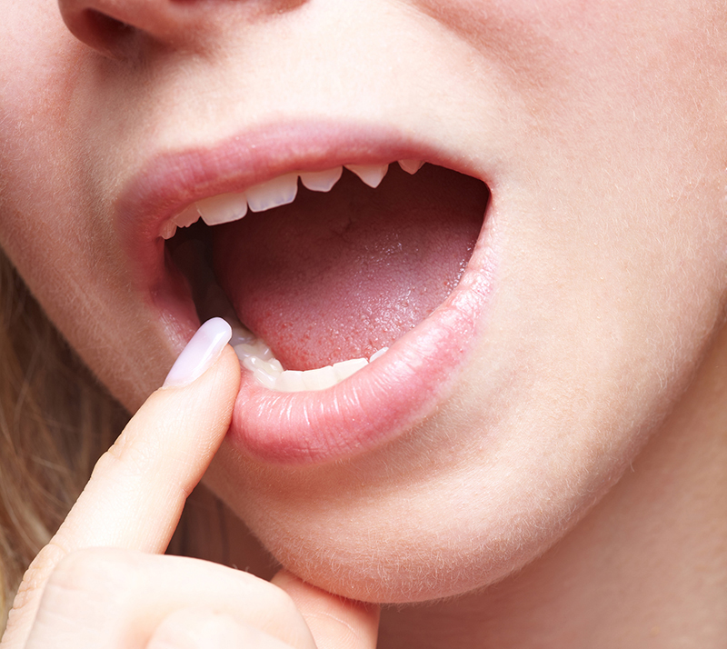 Young woman at dentist